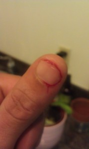 Eight seconds after a small cut to the thumb... Annoying, but not painful. This was done while shaving the flesh off of the mango seed after eating the fruit.